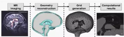 有限元在生物医疗三维人体建模方面的应用
