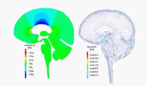 有限元在生物医疗三维人体建模方面的应用