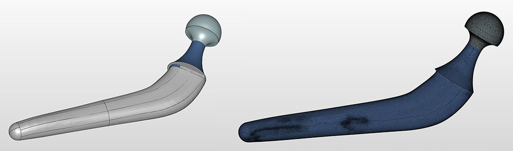 髋关节假体设计,CAE仿真帮大忙~