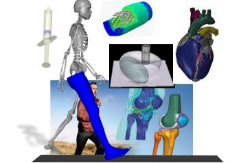 当医疗遇上CAE仿真，多的是你不知道的事儿！