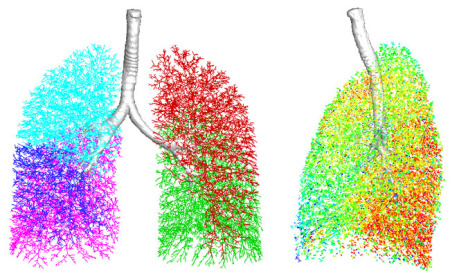 CFD仿真在生物医学领域拯救生命